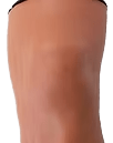Gphantom Knee